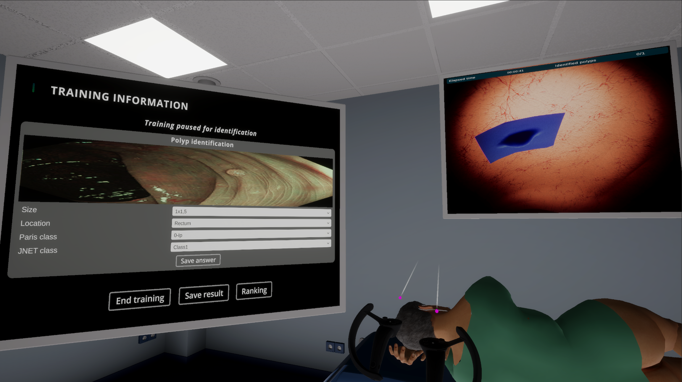 Polyp identification training in the VR simulator, v4.0