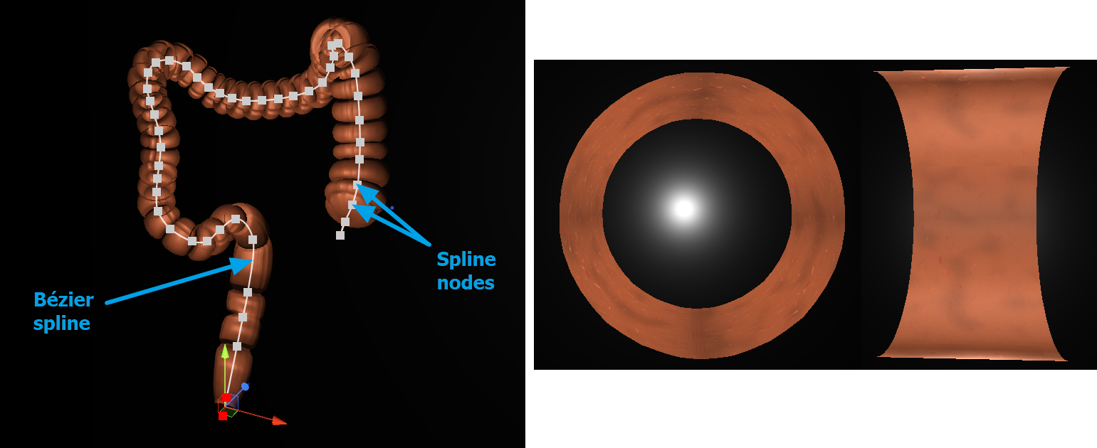 Canonical Model Shape and haustra model, the smaller component